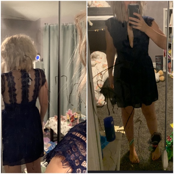 ASOS mini lace mini dress - Picture 6 of 6